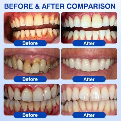 Targeted Gum Relief Gel